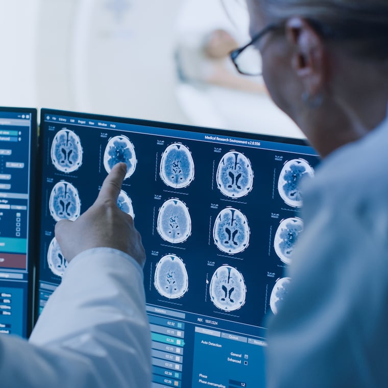 In Control Room Doctor and Radiologist Discuss Diagnosis while Watching Procedure and Monitors Showing Brain Scans Results, In the Background Patient Undergoes MRI or CT Scan Procedure.